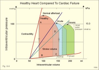 left ventricular pressure-volume loops