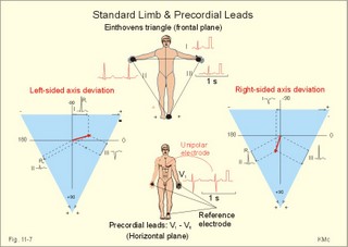 Einthoven's triangle