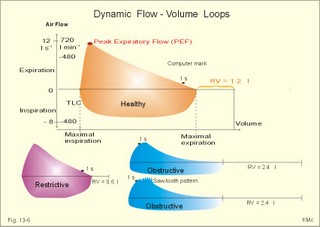 flow-volume loop