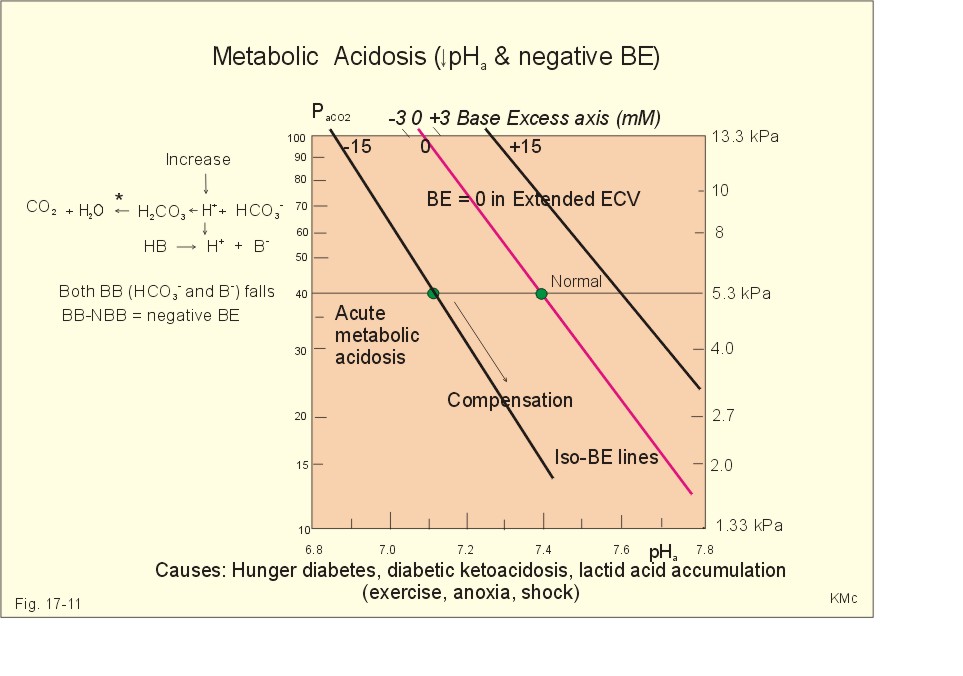 Metabolic Acidosis Graph