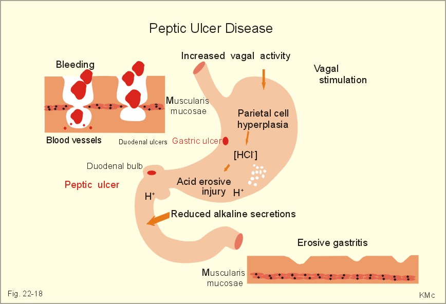 Intrinsic Factor Definition