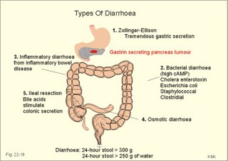 Diarrhoea