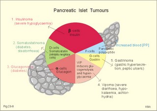 Endocrine pancreatic tumors