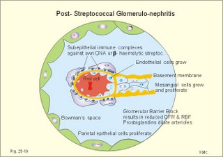 post streptococal glomerulonenephritis