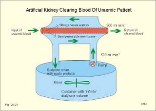 artificial kidney