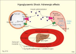 hypoglycaemic shock