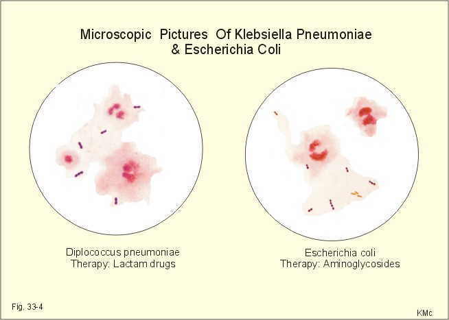 Klebsiella Pneumoniae Arrangement