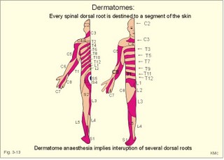 Dermatomes