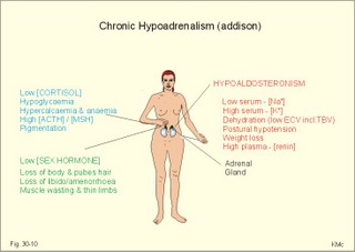 adrenocortical insufficiency