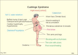 Manifestations of Cushing's syndrome