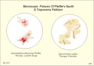 Haemophilus influenzae