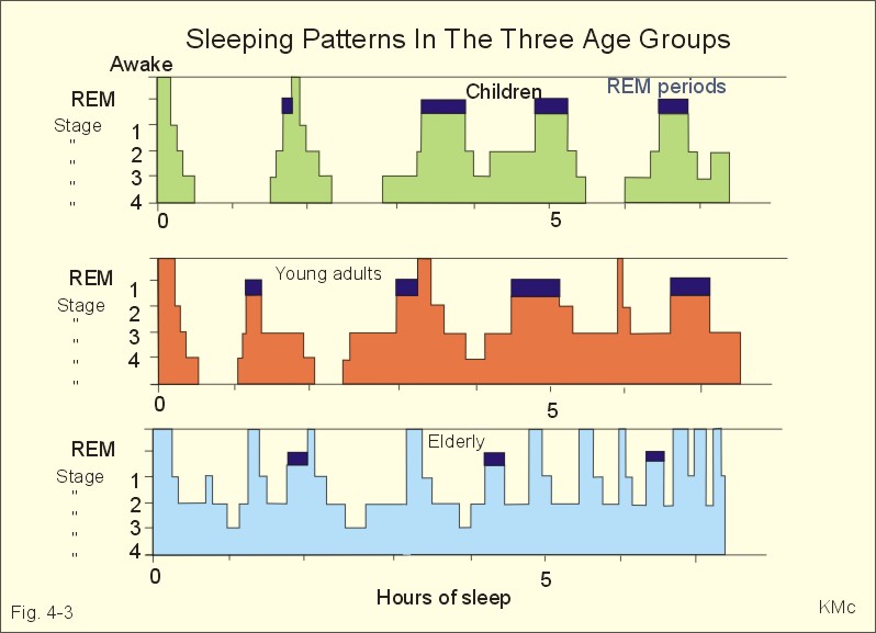 Irregular sleep wake rhythm - American Sleep Association